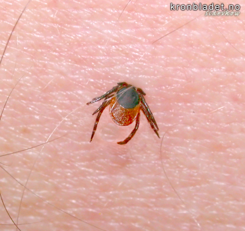 Skogfltt  (Ixodes ricinus) - fltt suger ut godsakene Sheep Tick (Ixodes ricinus) -  sucking out the good stuff